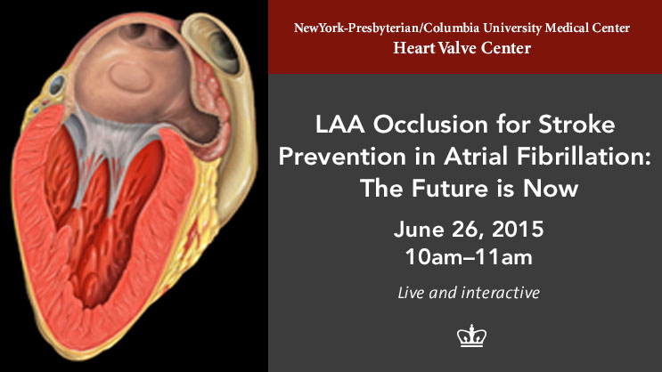 Banner: Left Atrial Appendage Occlusion for Stroke Prevention in Atrial Fibrillation: The Future is Now