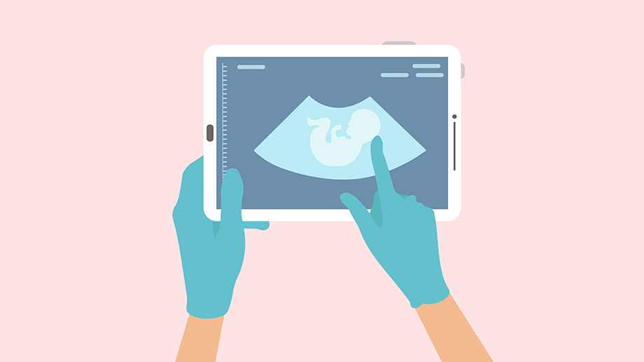 Digital 2D illustration of imaging of a fetus shown on a handheld device with surgeon's gloved hands holding the device and pointing to the fetus.