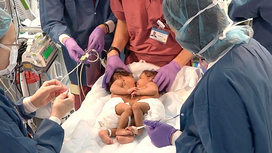 The nine-hour procedure involved more than 30 surgeons and specialists, including anesthesiologists, hepatologists, nurses, and technicians, from NewYork-Presbyterian and Columbia University Irving Medical Center. Photo courtesy of NYP.